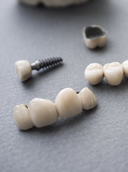A series of implant-retained restorations